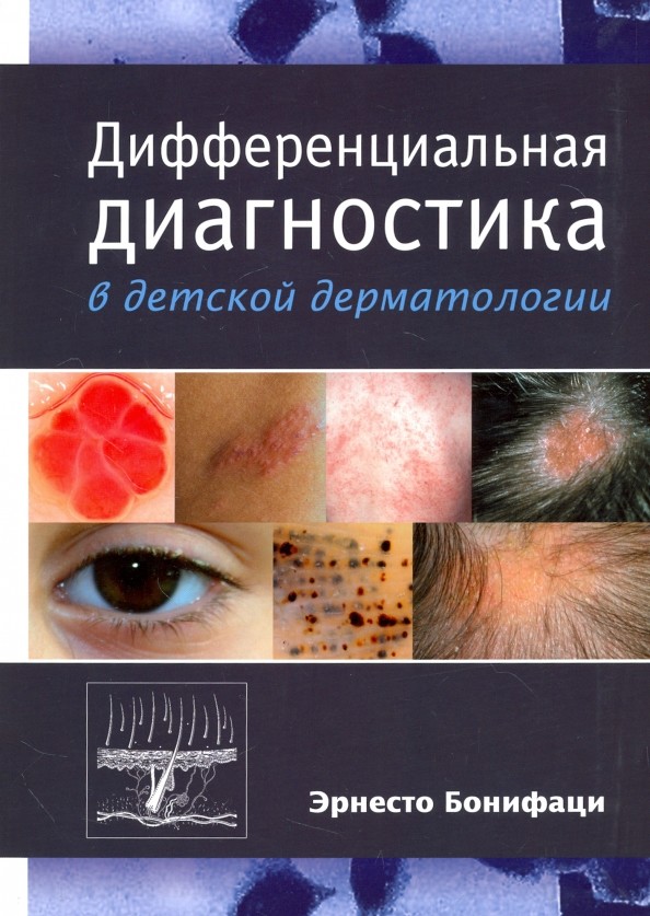 Дифференциальная диагностика в детской дерматологии