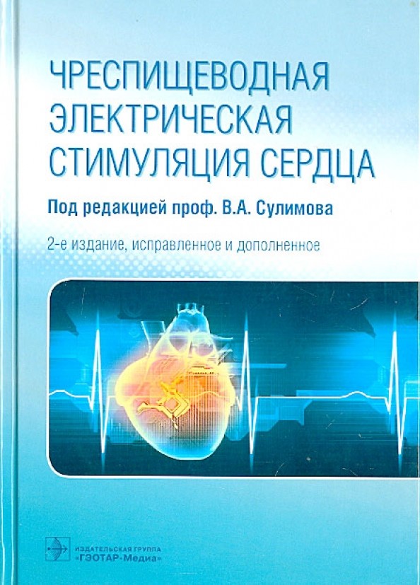 Чреспищеводная электрическая стимуляция сердца