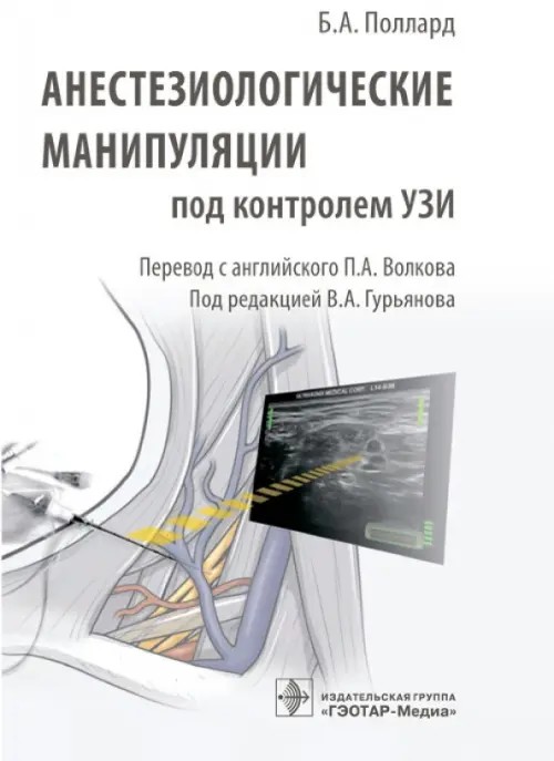 Анестезиологические манипуляции под контролем УЗИ